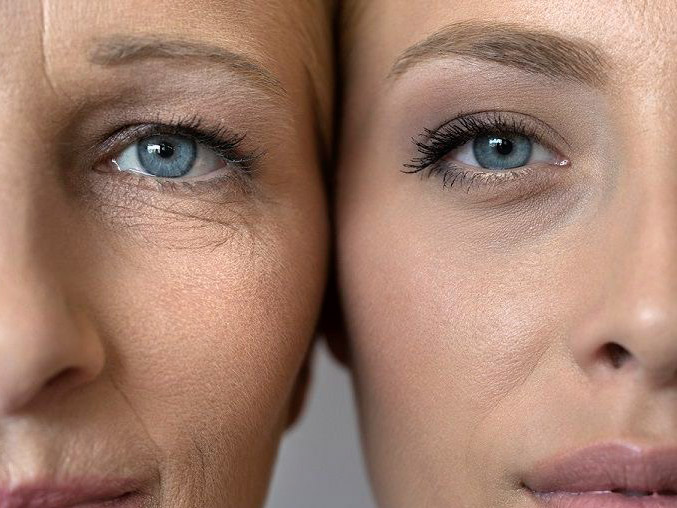 Кожа и стресс